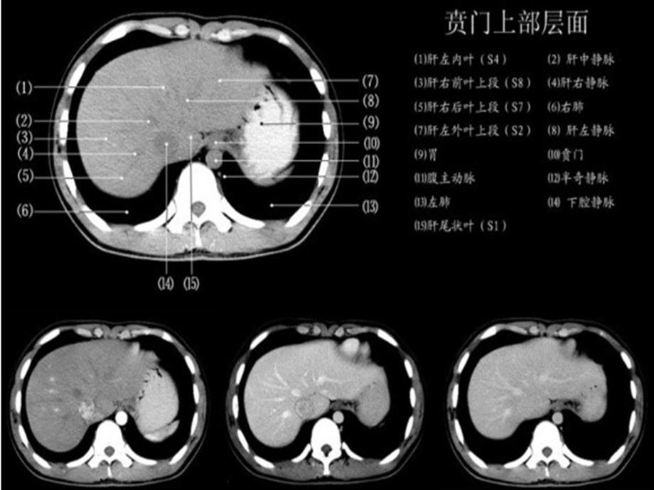 腹部正常CT图解入门.ppt_第2页