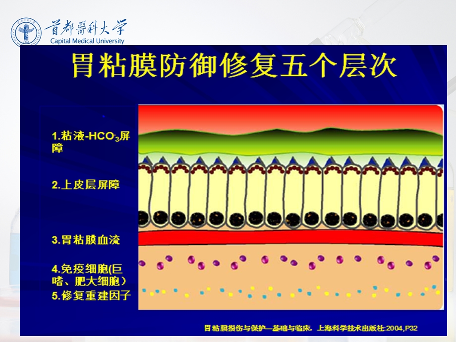 消化系统疾病总论4-04胃炎.ppt_第3页