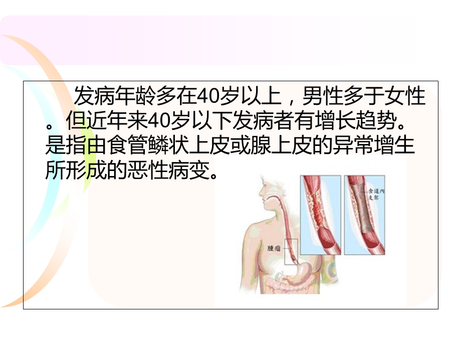 食管癌病人围手术期的护理.ppt_第3页