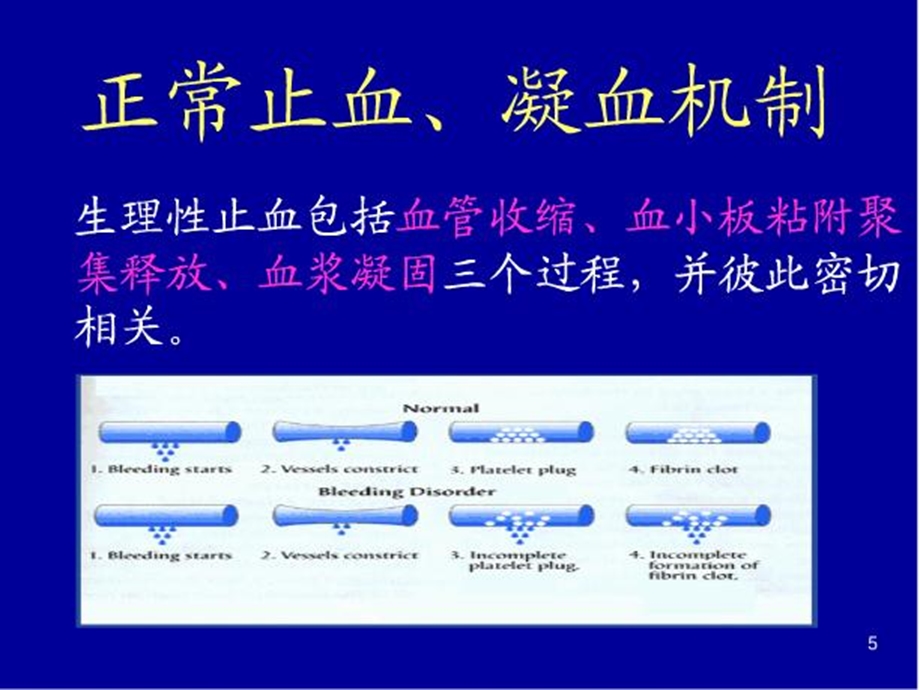 《出血性疾病》课件.ppt_第3页