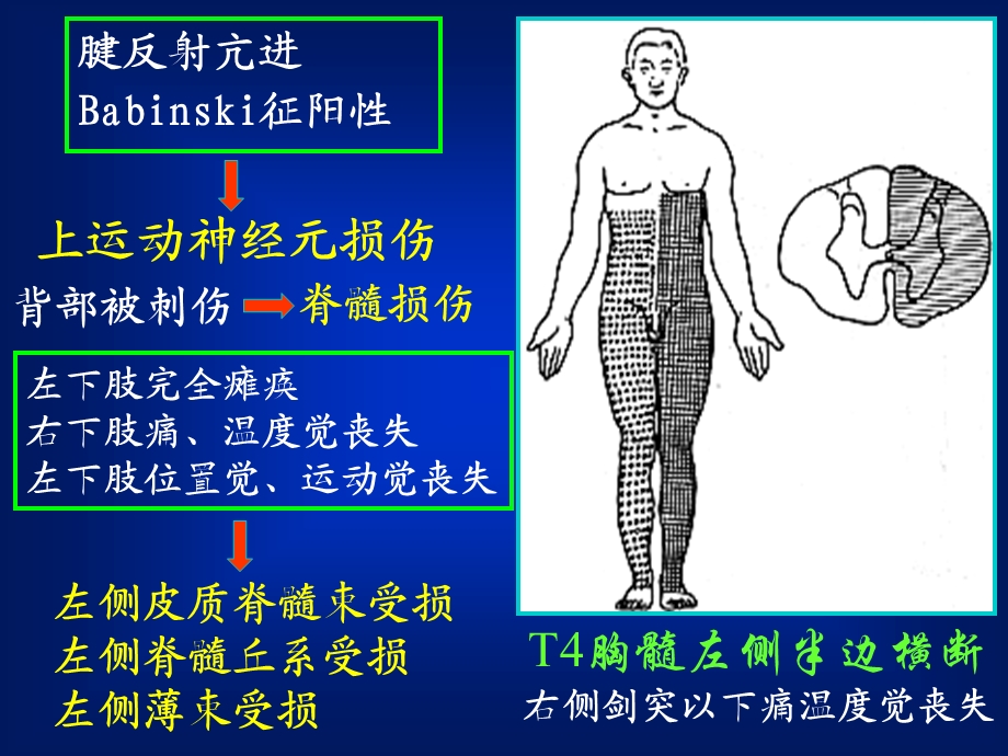 系统解剖学6周围神经.ppt_第3页