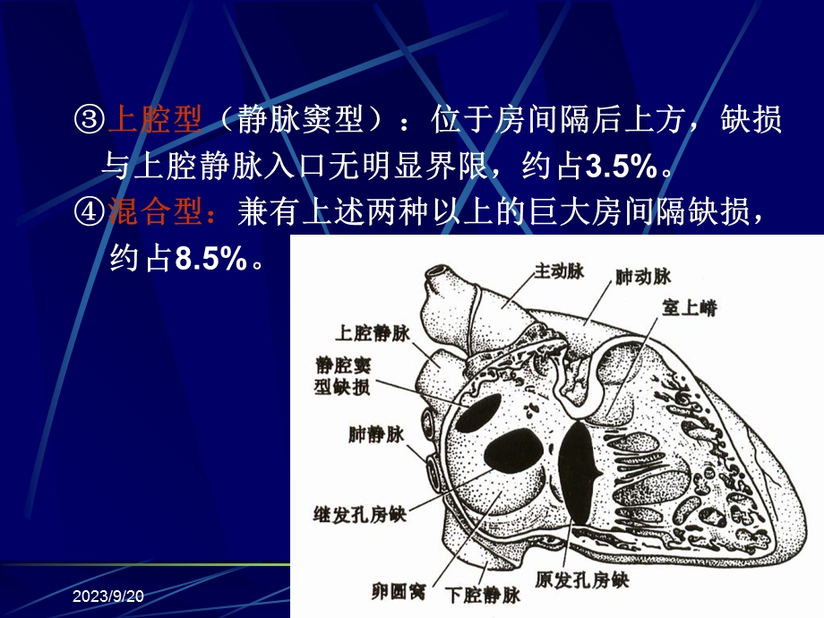 《先天性心脏病》课件.ppt_第3页