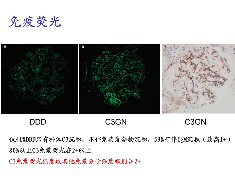 最新c3肾小球肾病 ppt课件PPT文档.ppt_第3页