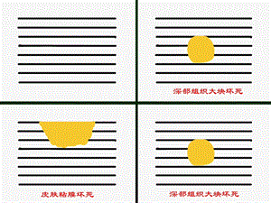 3第三章局部血液循环障碍PPT文档精选文档.ppt