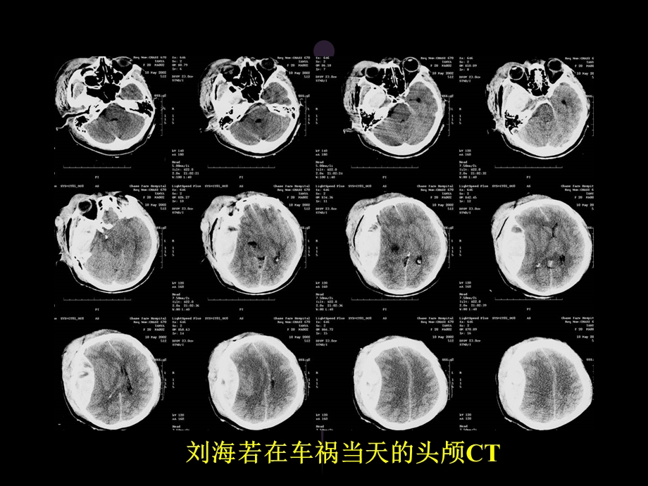 全科医师康复医学概论文档资料.ppt_第3页