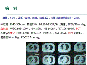 esbls的耐药机制及抗菌药物应用原则文档资料.ppt