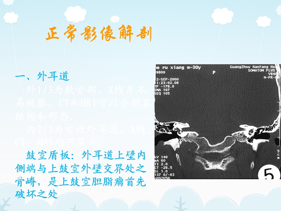 医学影像耳的影像解剖及常见疾病诊断文档资料.ppt_第2页