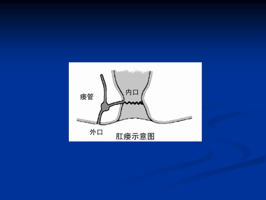 肛瘘手术文档资料.ppt_第2页