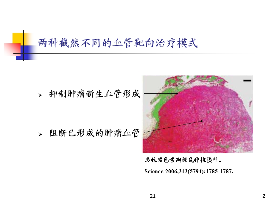 “肿瘤血管阻断剂”一类崭新的肿瘤血管靶向治疗药物文档资料.ppt_第2页