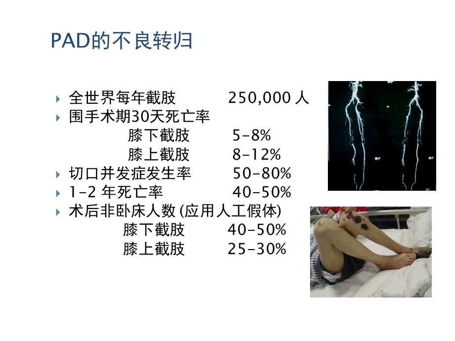 下肢动脉硬化的药物治疗新选择安步乐克文档资料.ppt_第3页