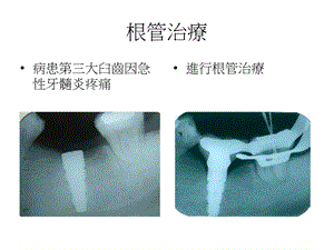 【医药健康】牙髓病科病例文档资料.ppt