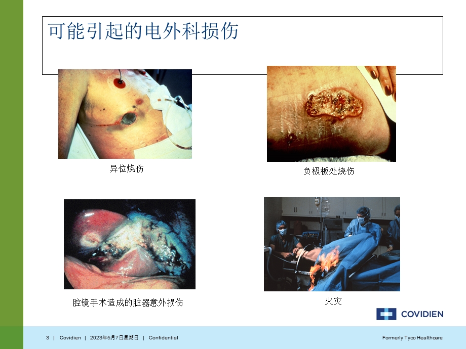 最新：Covidien电外科安全讲座文档资料.ppt_第3页