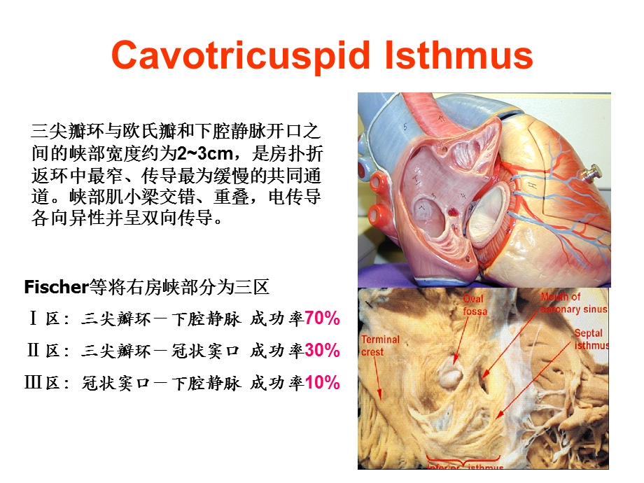 心房解剖精选文档.ppt_第2页