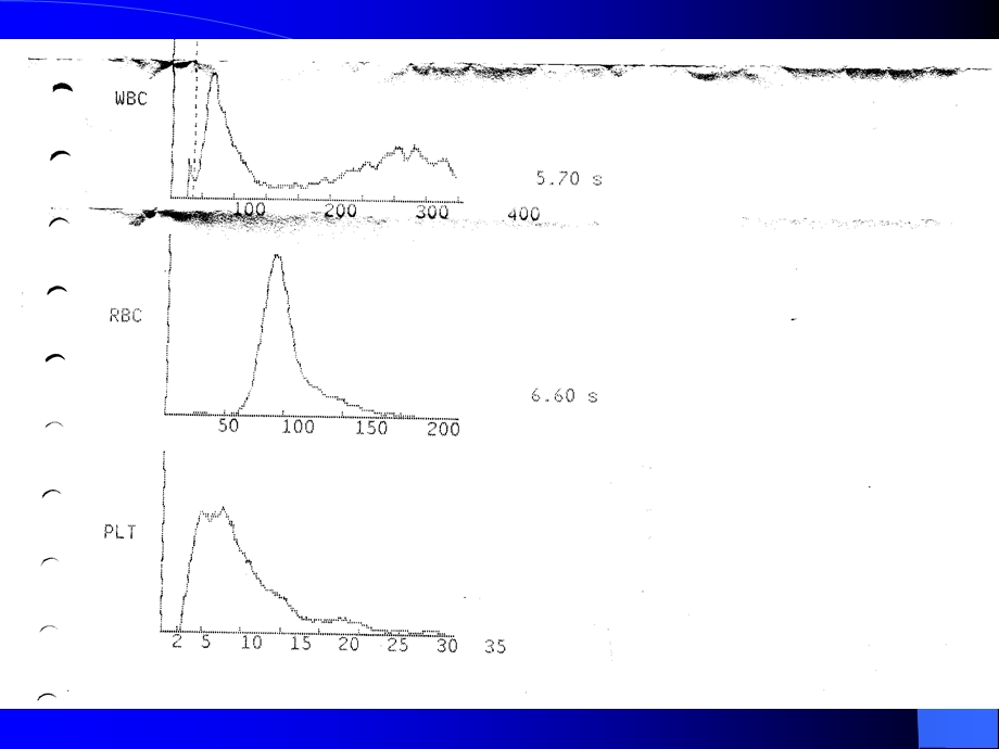 医学课件妊娠合并贫血文档资料.ppt_第1页