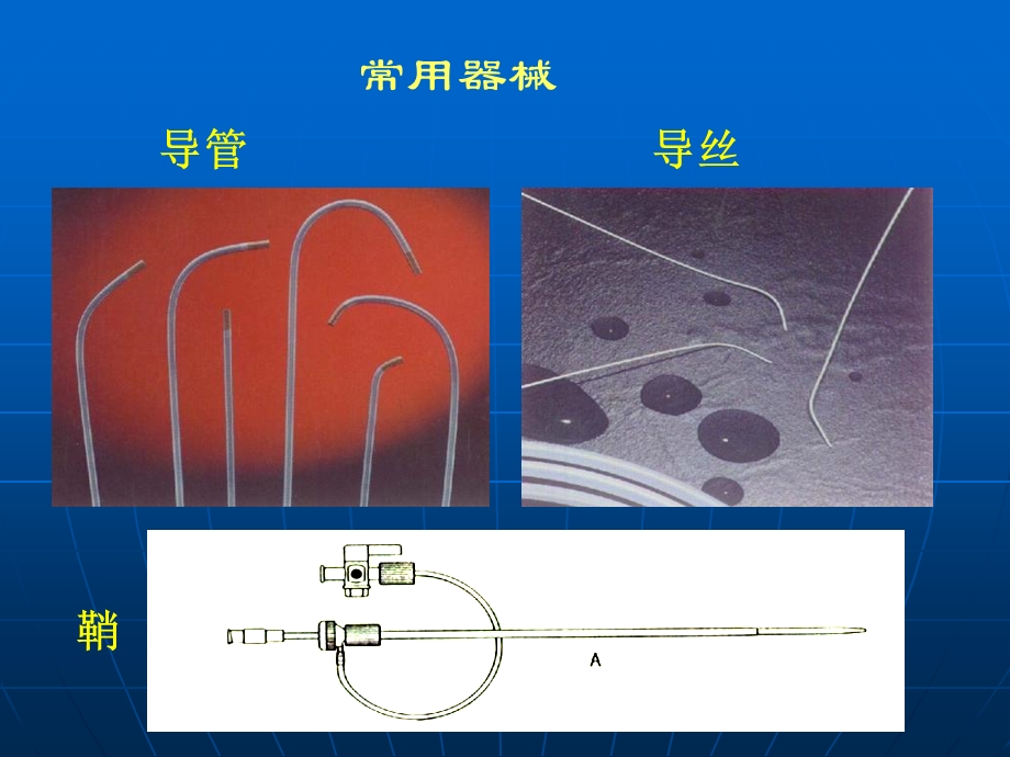 介入放射学在妇产科疾病中应用文档资料.ppt_第2页