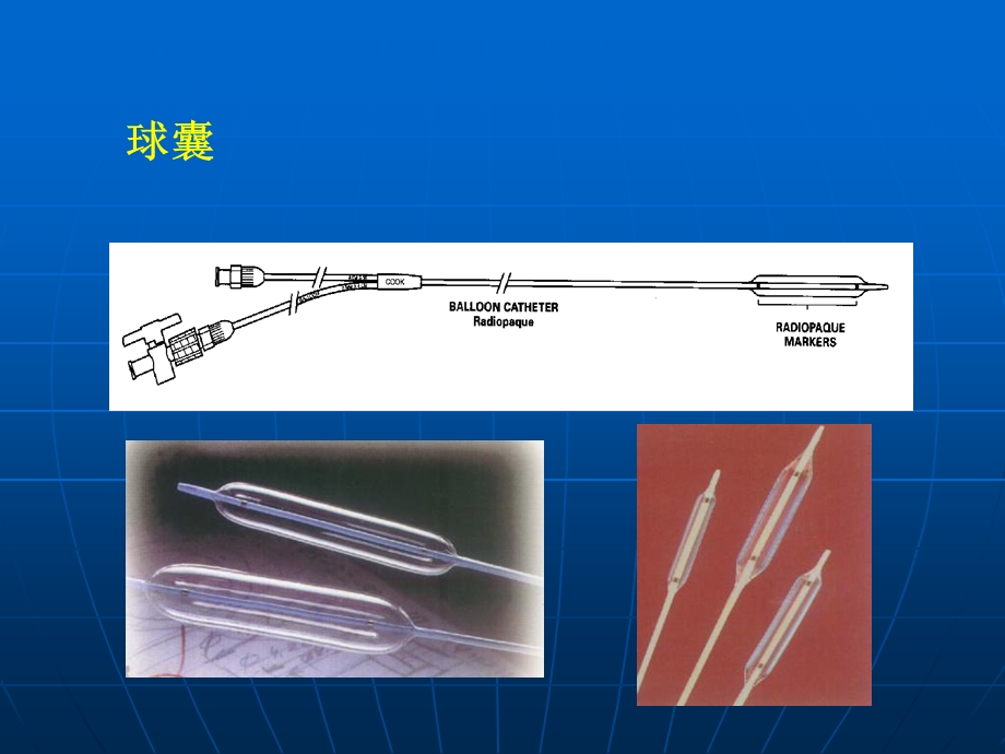 介入放射学在妇产科疾病中应用文档资料.ppt_第3页