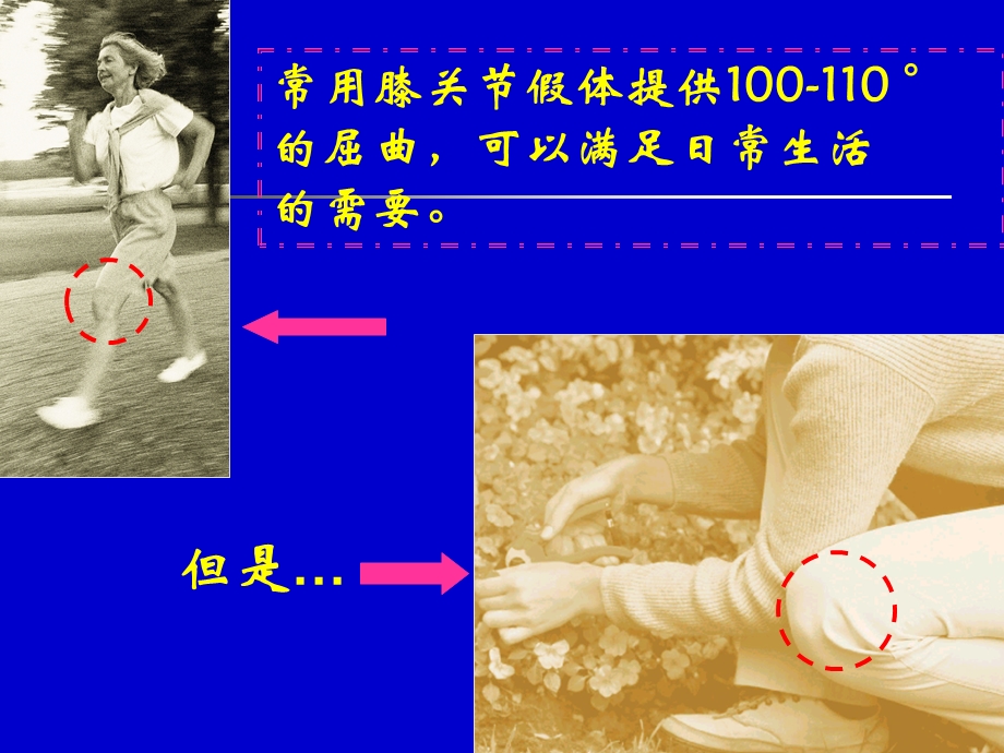 全膝关节置换后活动度文档资料.ppt_第1页