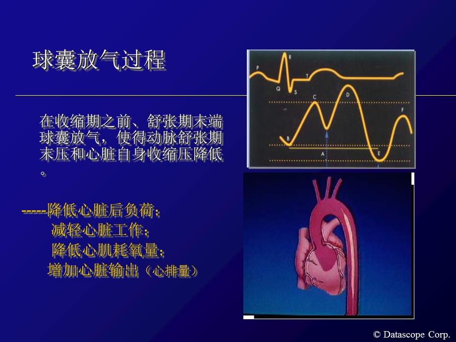 IABP主动脉内球囊反搏泵的临床使用PPT文档.ppt_第3页