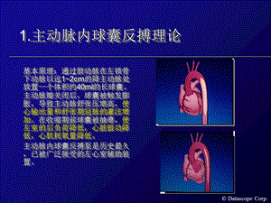 IABP主动脉内球囊反搏泵的临床使用PPT文档.ppt