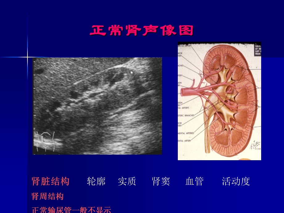 【医药健康】泌尿系疾病超声诊断文档资料.ppt_第3页