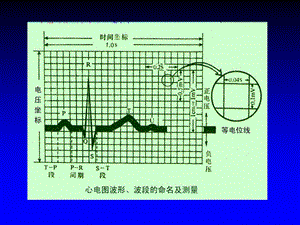 最新c第二节正常心电图PPT文档.ppt