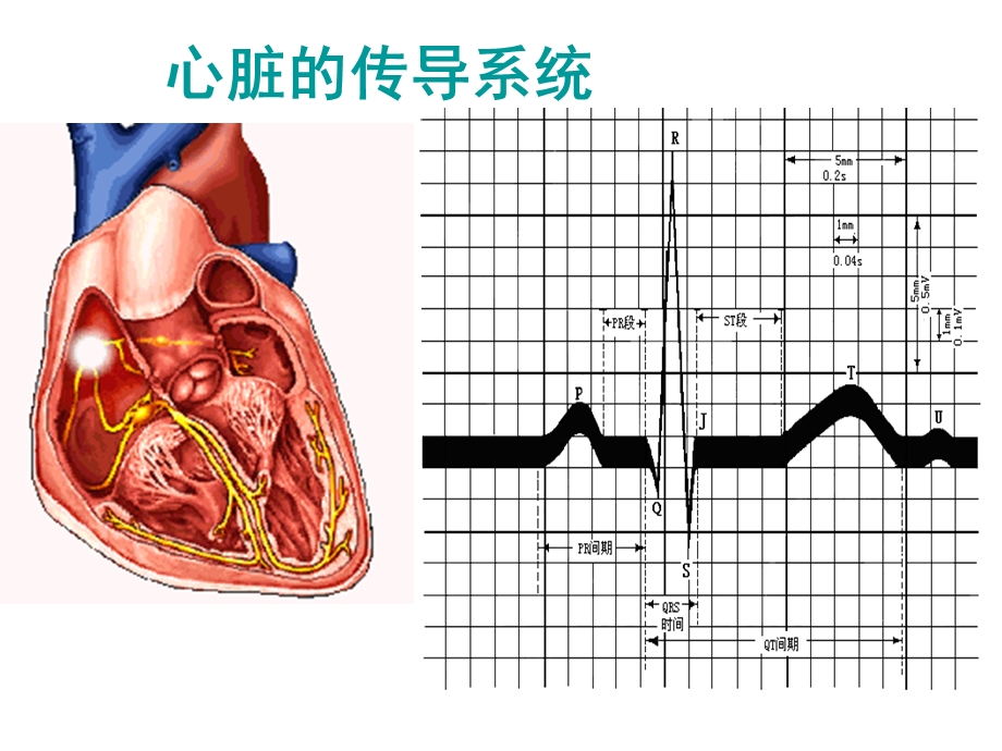 心电图PPT文档.ppt_第3页