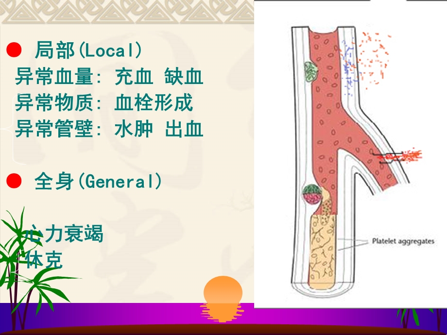 血液循环障碍PPT课件文档资料.ppt_第2页