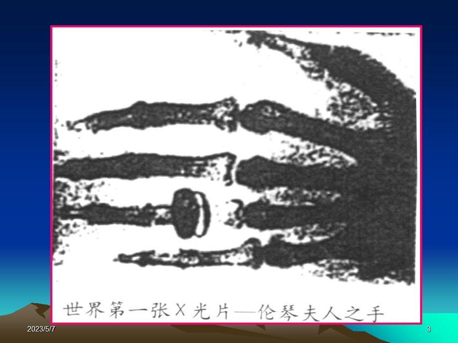 x线诊断学医疗专业文档资料.ppt_第3页