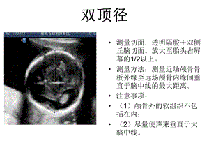 产科超声标准切面25张.ppt