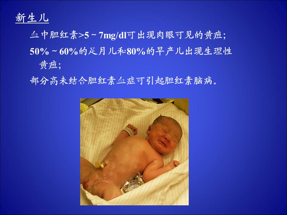 《生儿黄疸》课件.ppt_第3页