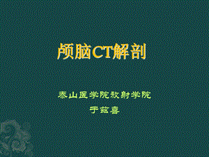 《颅脑ct解剖》ppt课件.ppt