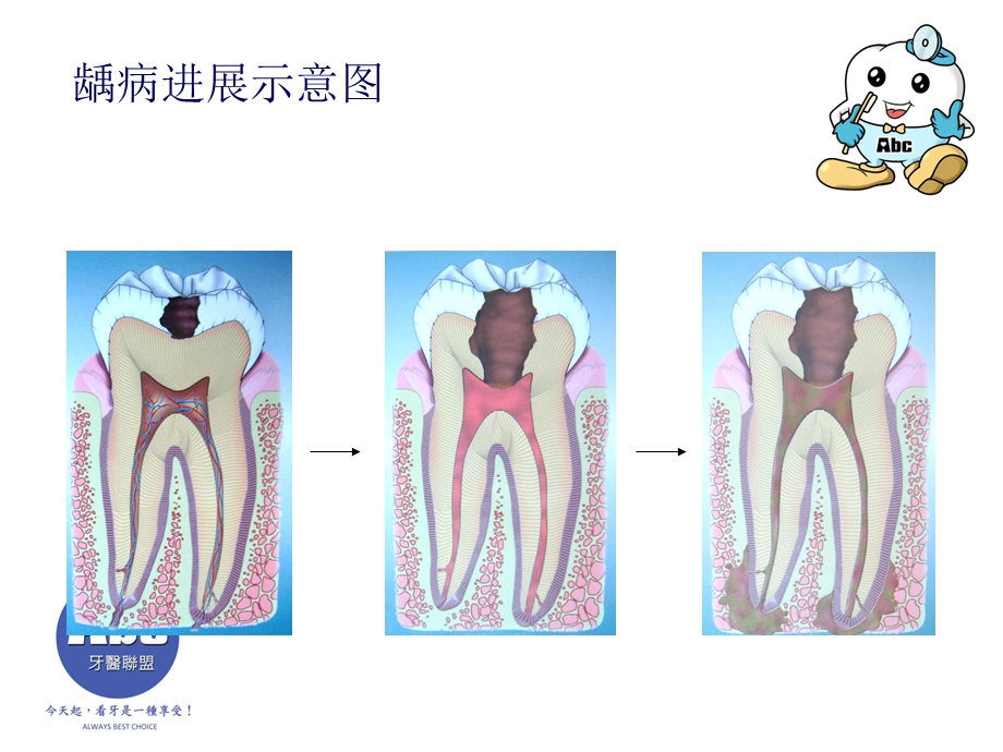 儿童口腔卫生保健ppt课件.ppt_第3页