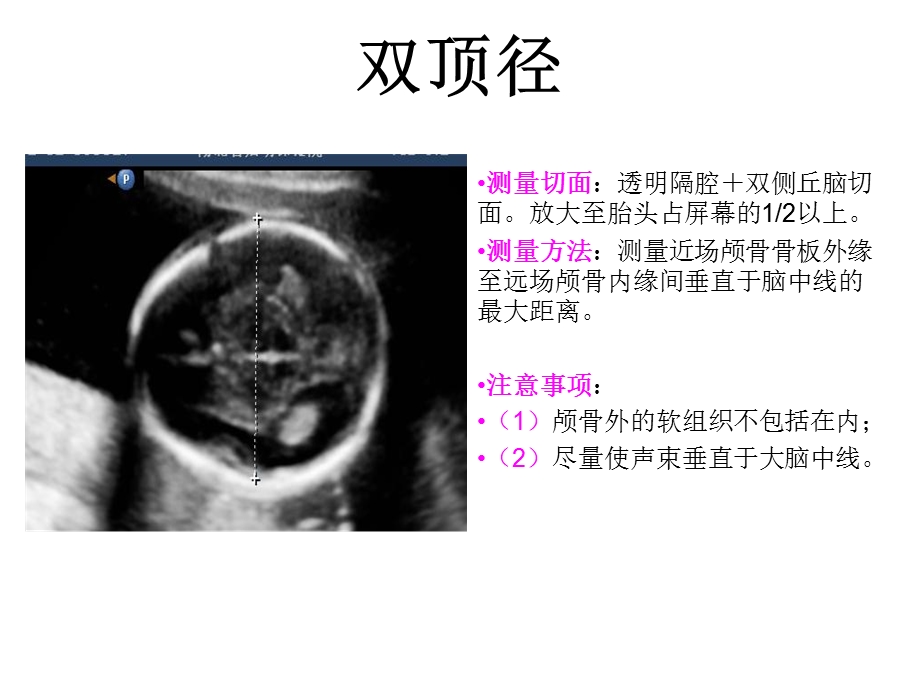 产科检查常规切面.ppt_第3页