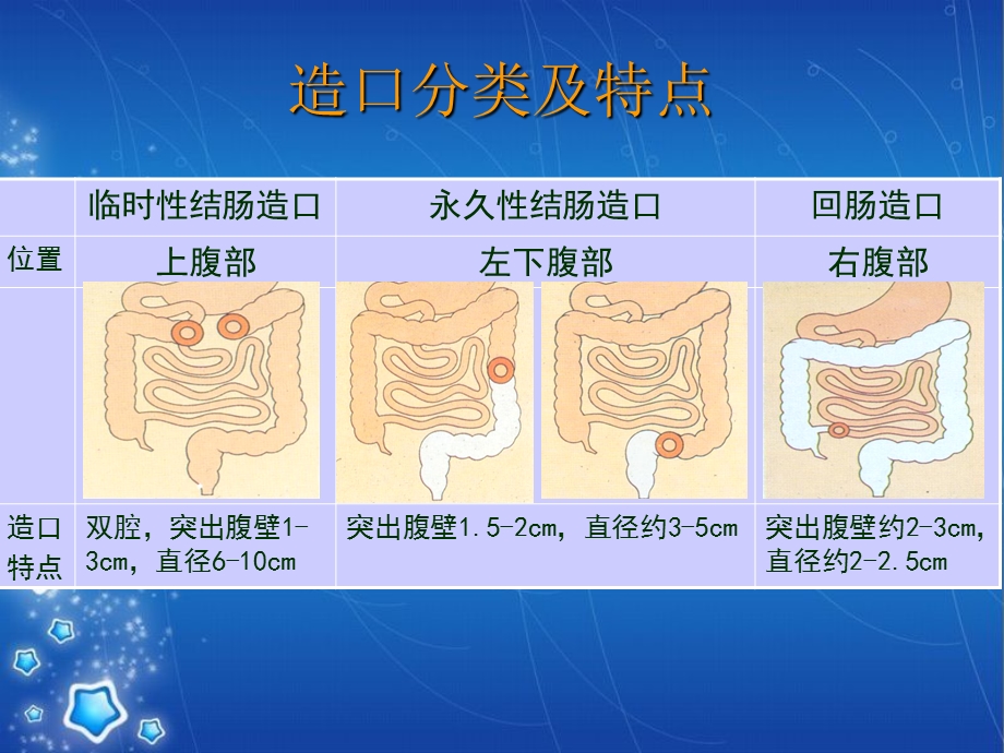 《肠造口护理9w》ppt课件.ppt_第2页