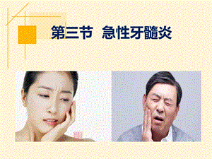 《急性牙髓炎》ppt课件.ppt