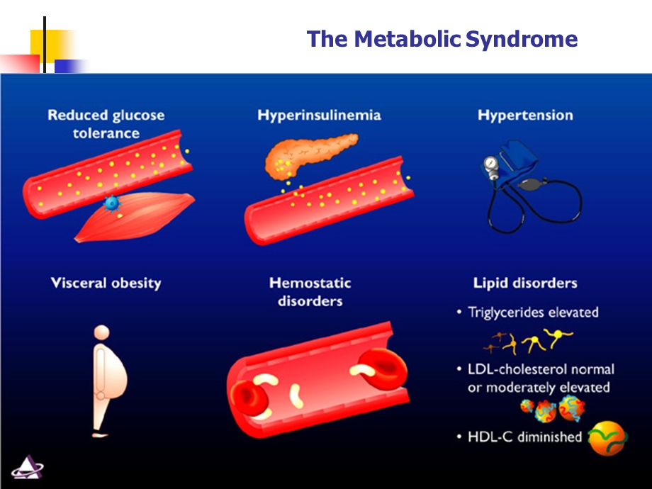 代谢综合征-戴小华.ppt_第2页