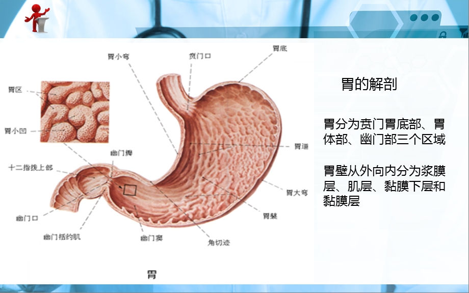 《外科护理》第十五章第二节胃十二指肠溃疡.ppt_第2页