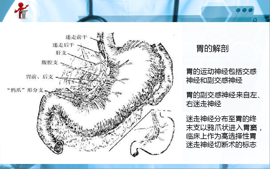 《外科护理》第十五章第二节胃十二指肠溃疡.ppt_第3页