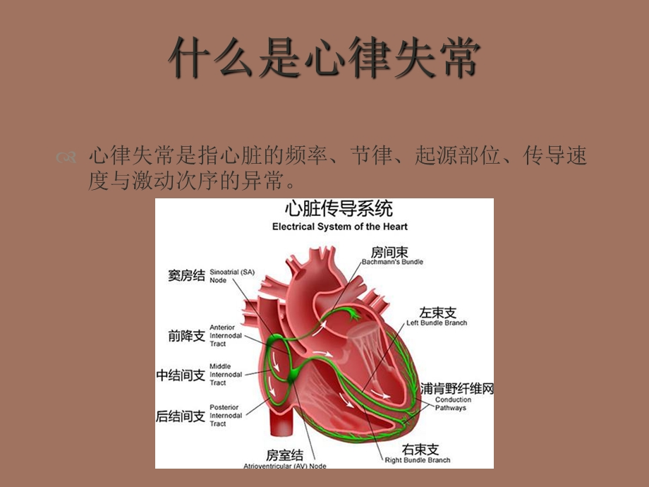 儿童常见心律失常的诊治.ppt_第2页