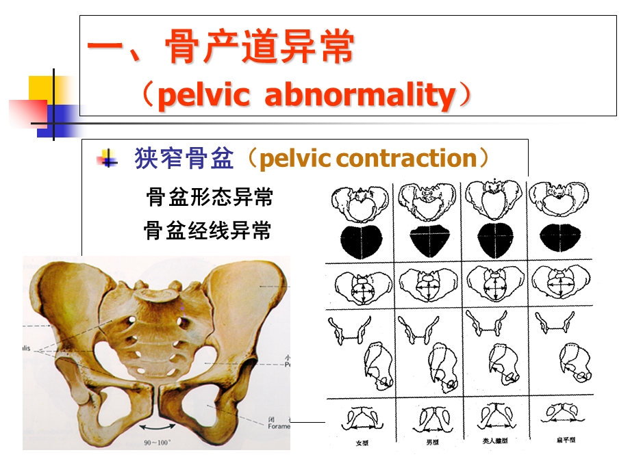 产道异常的分类和临床表现.ppt_第3页