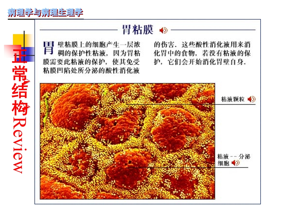 《慢性胃炎》课件.ppt_第3页