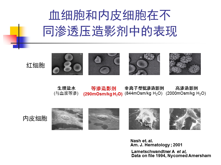 《造影剂肾病新》ppt课件.ppt_第3页