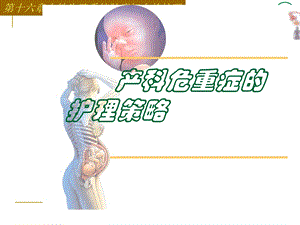 产科危重症的护理策略.ppt