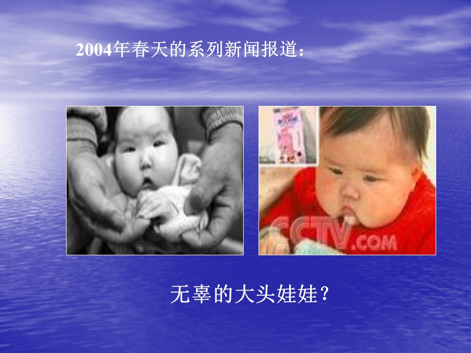 《水盐代谢紊乱》课件.ppt_第3页