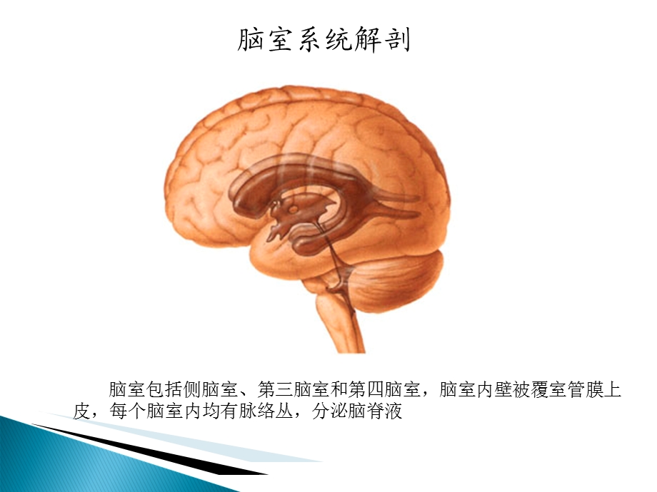 侧脑室肿瘤的诊断与鉴别ppt课件.ppt_第2页