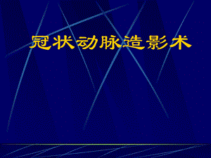 冠脉造影术基础及指引导管选择.ppt