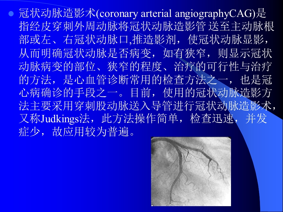 冠状动脉造影术的术前及术.ppt_第2页