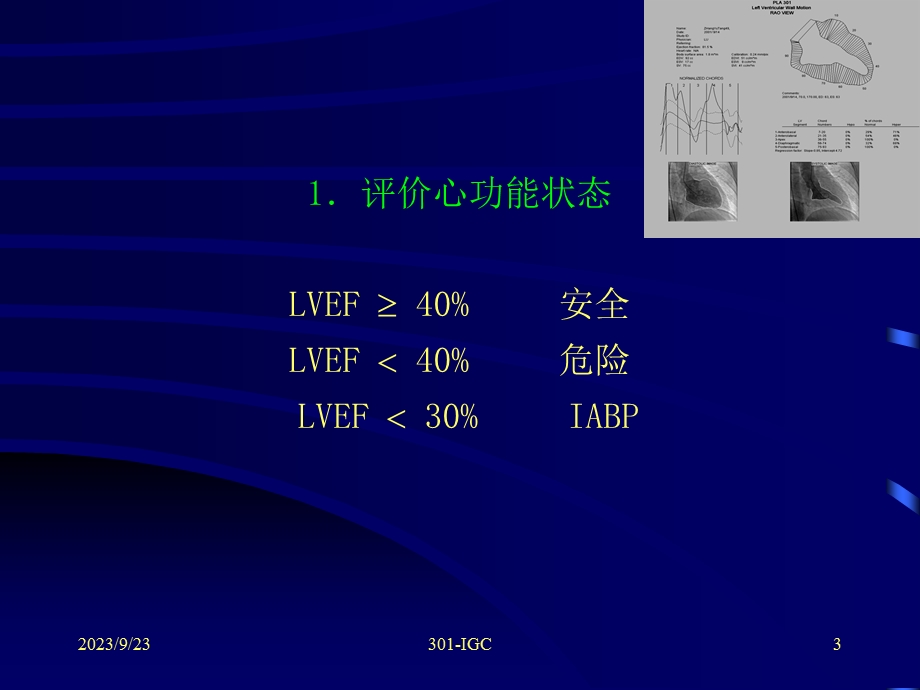 冠心病介入治疗操作要点和并发症防治(北大.ppt_第3页