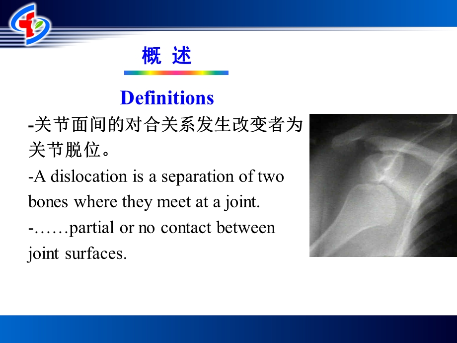 关节损伤和脱位.ppt_第3页