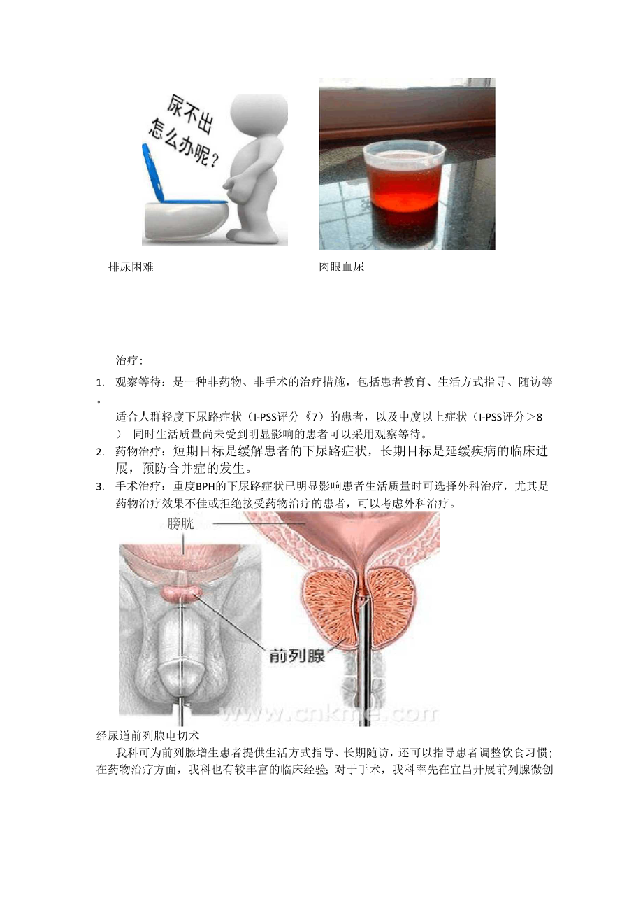 前列腺增生的健康教育1.docx_第2页